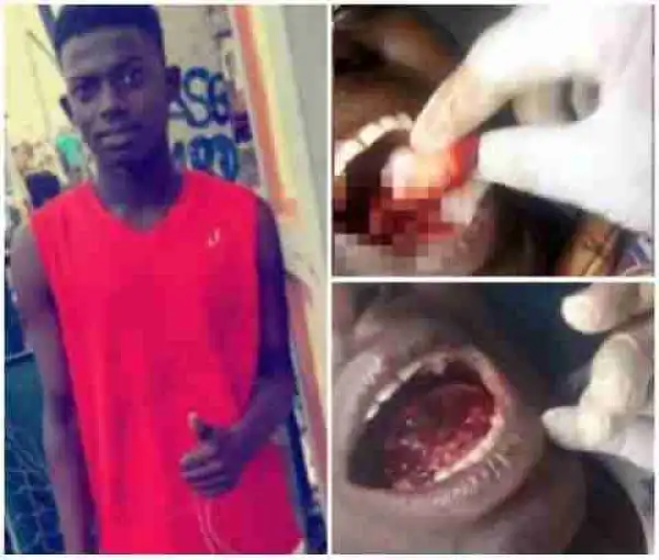 Lady Chops Off Male Neighbor’s Tongue For Rituals (Graphic Photos)